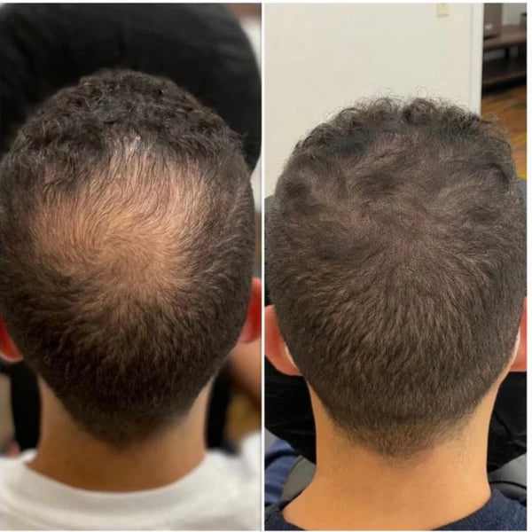 Rosemary Hair Growth Serum