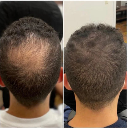 Rosemary Hair Growth Serum